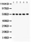 Anti-AGFG1 Antibody